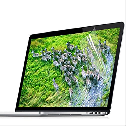 Se7enline M-C0016 Schutzhülle, macbook pro 13 with Retina(Model A1502/A1425), gold - 8