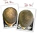 Dark Brown Hair Building Fibers Large 22g Pack Amazing New Concept to Save Money, Fibres For use by Men and Women