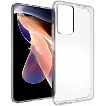 Glitzer-Handyhülle Für Xiaomi Redmi Note 11/11s – Mit Kameraschutz, Schwarz-gold, TPU Silikon