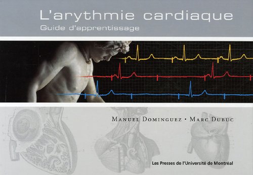 Arythmie cardiaque : Guide d'apprentissage francais