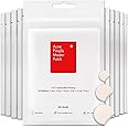 Acne Pimple Patch, Absorbing Hydrocolloid Original, Hydrocolloid Acne Pimple Patch, Patches for Blemishes and Zits Cover, Spot Stickers for Face and Body, 3 Size, Vegan and Cruelty Free (10 Count)