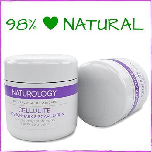 Naturology Stretch Mark, Cellulite & Scar Removal 3-1 Cream with Retinol. 98% Natural treatment targets your problem areas, toning and firming your legs, arms, stomach and buttocks, our advanced formula contains the best organic anti-oxidant ingredients available, developed to be soothing, delicate yet powerful. Use this lotion on it's own or with your massager, brush, scrub, or roller. Works quickly to hydrate, repair & restore your skins softness & suppleness.