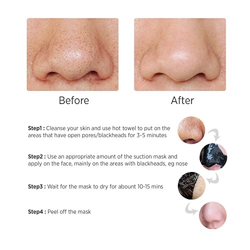 Mitesser Entferner Maske – Vena Beauty Mitesser Entfernungs-Maske, Akne Maske, Reinigungs-Maske, Gesichtsmaske schwarz - 3
