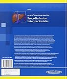 Image de Diagnóstico por Imagen. Procedimientos Intervencionistas