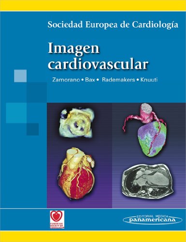 SEC-ZAMORANO:Imagen Cardiovascular