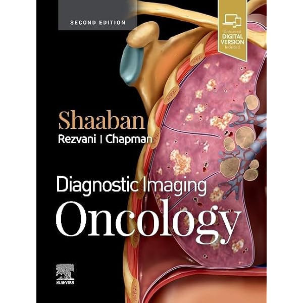 Buy DIAGNOSTIC IMAGING: CHEST, 3RD EDITION Book Online at Low