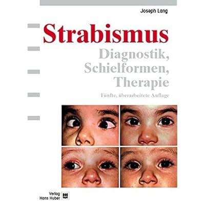 [PDF] Strabismus: Diagnostik - Schielformen - Therapie KOSTENLOS DOWNLOAD