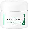 Azonee Scar Removal Cream, Acne Scar Treatment, Scar Gel, For Surgical Scars, Stretch Mark Scar Treatment, Skin Repair Cream, For Scar Removal, Reduce The Appearance of Scars