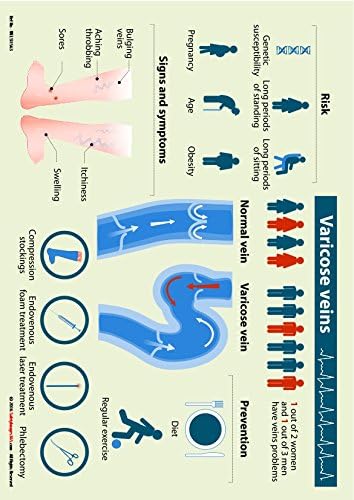 Varicose Veins-Land