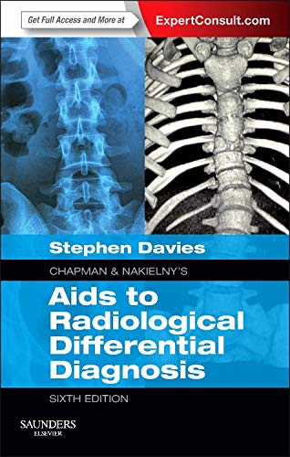 Chapman & Nakielny's Aids to Radiological Differential Diagnosis: Expert Consult - Online and Print,
