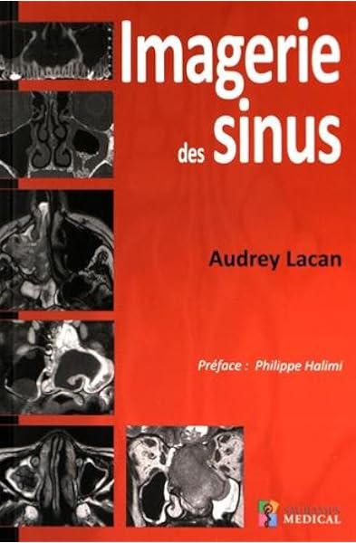 Imagerie Des Sinus Lacan Audrey Halimi Philippe Livres Amazon Fr