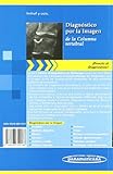 Image de Diagnóstico por la Imagen: de la Columna vertebral (Directo Al Diagnostico En Radiologia / Direct Diagnosis in Radiology)
