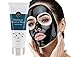 *NEW ULTRA POWER* Blackhead Removal Charcoal Face Masks Pore Mask Treatment Best Blackhead Remover Face Mask with Activated Charcoal Detox Mask Prevents Acne Quick Results After first treatment Day & Night Care