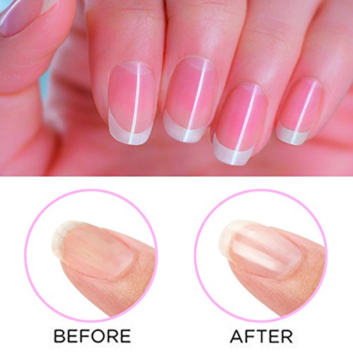 Gotofine Elektrische Nagelpolierer Nagelfeile Puffer, Elektrischer Persönliche Nagelpflege system, Feilen, Polieren und glätten Sofort(inkl. 3 Rollern) - 5