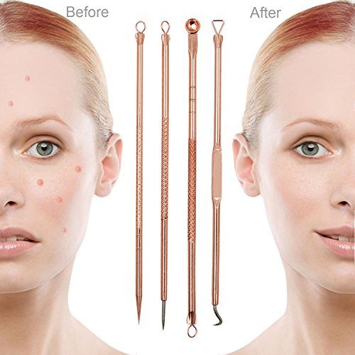 Mitesserentferner, Becoyou 4 Stücke Komedonenquetscher Set aus Edelstahl Pickel Extraktor Professionell Gesundheit Behandlung für Pickel Whiteheads Akne Extraktoren - 7