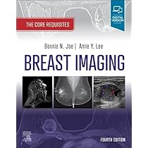 Buy Diagnostic Imaging Breast With Access Code 3Ed (Hb 2019