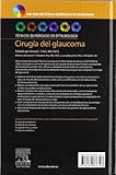 Image de Cirugía del glaucoma + DVD-ROM