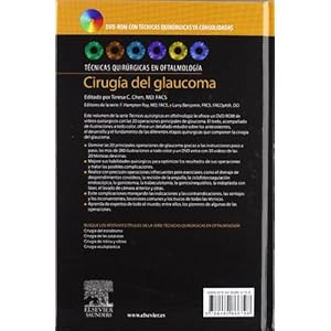 Cirugía del glaucoma + DVD-ROM
