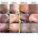 Jspoir Melodiz 100g Crystal Cream Aloe Vera Masks Black Cleaner Acne Head Deep Clean Removing Eliminate Blackhead Treatments Facial Mask Peel Mask Acne Treatment