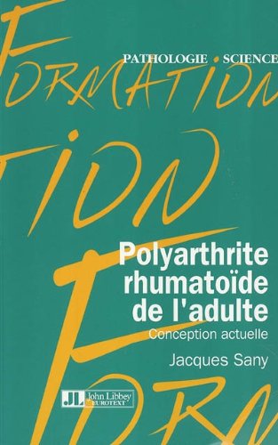 Book's Cover ofPolyarthrite rhumatoïde de ladulte  Conception actuelle
