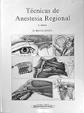 Image de Técnicas de anestesia regional.