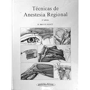Técnicas de anestesia regional.