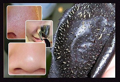 Black Head Peel off Schwarze Maske Mask Killer Gesichtsmaske Pickel 50 ml - 3