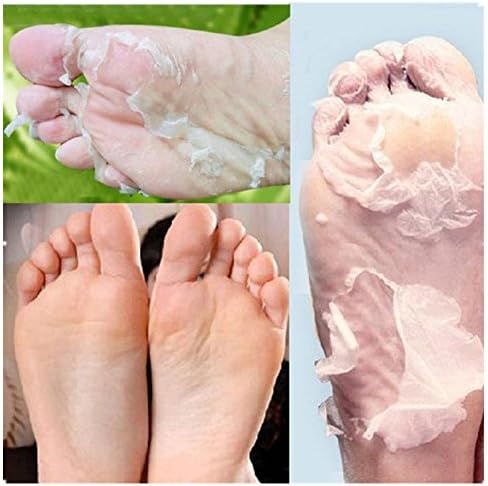DIAOWEI Feet Peel Mask- Exfoliating Renew Dead Skin Cuticles Heel Feet Care-1 Pair (Marigolds)