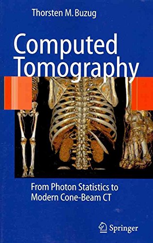 [Computed Tomography: From Photon Statistics to Modern Cone-beam CT] (By: Thorsten M. Buzug) [published: December, 2010]