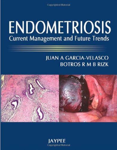 Endometriosis: Current Management and Future Trends