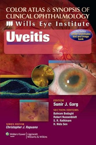 Color Atlas & Synopsis of Clinical Ophthalmology (Wills Eye Institute) - Uveitis