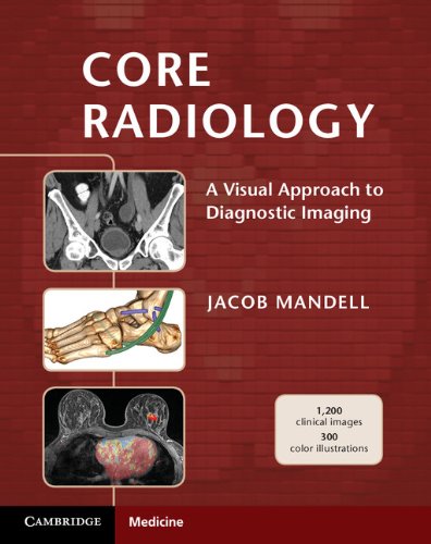 Core Radiology: A Visual Approach to Diagnostic Imaging (English Edition)