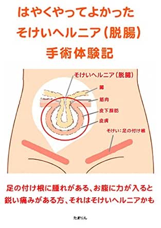 Hayakuyatteyokatta Sokeiherunia Dattyou Syujyututaikennki Japanese Edition Ebook Tamarin Amazon In Kindle Store Hayakuyatteyokatta Sokeiherunia Dattyou Syujyututaikennki Japanese Edition Ebook Tamarin Amazon In Kindle Store