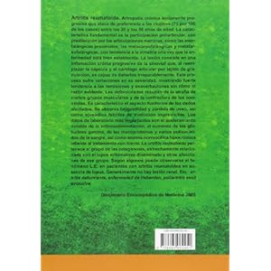 Mi Batalla Contra La Artritis Reumatoide