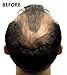 Super Million Hair - 1 x 25g Hair Building Fibres - No.2 Dark Brown