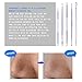 Blackhead Whitehead Remover 5 in 1 Blemish Blackhead Extractor- Wuudi Blemish Zit Acne Pimple Extractor Tools Comedone Removal Kit for Risk Free Nose Face Skin with Metal Case (5 Pieces)