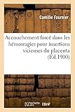 Image de Accouchement forcé dans les hémorragies pour insertions vicieuses du placenta