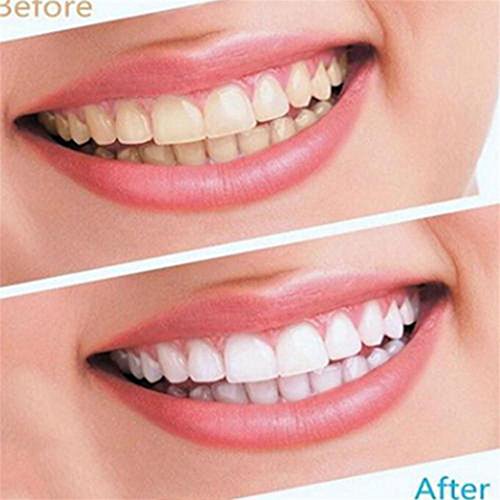 Tonsee 28PCS Weiße Effekte Dental Whitestrips Hoch Entwickelten Zähne Streifen - 2
