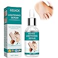 Azonee Skin Whitening Serum for Body, Dark Spot Remover for Underarms, Armpits, Knees, Inner Thigh, Hyperpigmentation Treatment, Lightening Cream for Dark Spots, Moisturizing