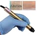 DM9050 Hair removal at home and salon pro treatments, permanent system.