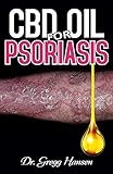  CBD OIL FOR PSORIASIS: The Medicinal Power of CBD Oil in Treating Dry, Red and Scaly Patches on the Skin. Discover the Truth! (English Edition)