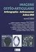 Produktbild Imagerie ostéo-articulaire : Arthrographie, arthroscanner, arthro-IRM