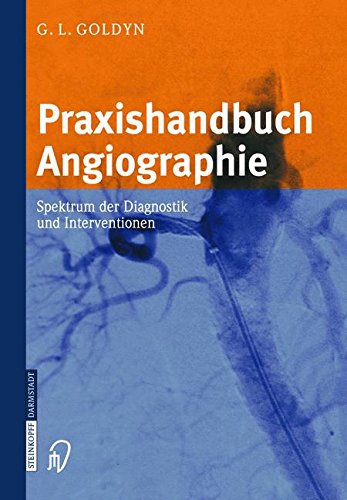 Download Praxishandbuch Angiographie. Spektrum der Diagnostik und Interventionen Download Praxishandbuch Angiographie. Spektrum der Diagnostik und Interventionen