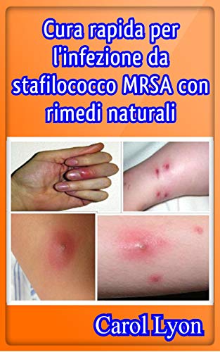 Cura Rapida Per L Infezione Da Stafilococco Mrsa Con Rimedi