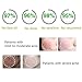 LuckyFine Acne Remove Anti-acne Scar Blemish Face Skin Care Treatment Aloe Vera Gel