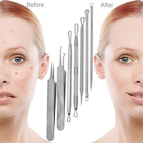 Becoyou 7 Stücke Mitesserentferner mit Lederhülse – Komedonenquetscher Set aus Edelstahl – Nagelhautschieber Werkzeug Pickel Whiteheads Akne Extraktoren für Gesundheit Behandlung - 8