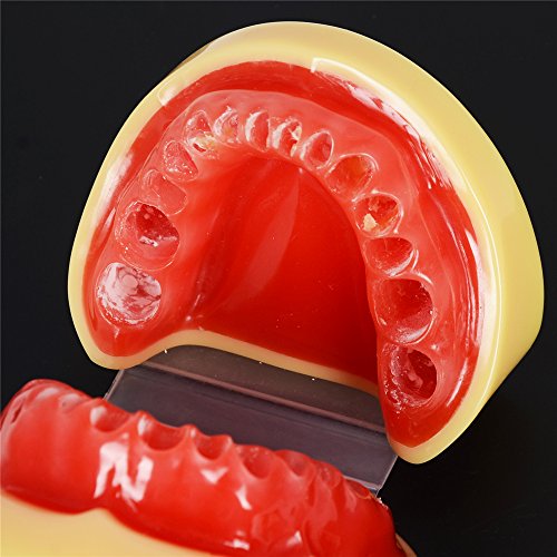 Etelux A11 Dental Teach Studie Erwachsene Standard 28 pcs Demonstration Zähne Modell Flesh Pulver - 4