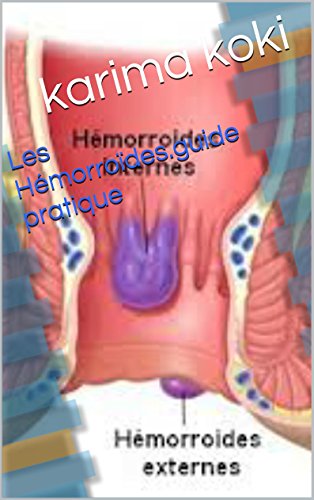Download Les Hémorroïdes.guide pratique Download Les Hémorroïdes.guide pratique