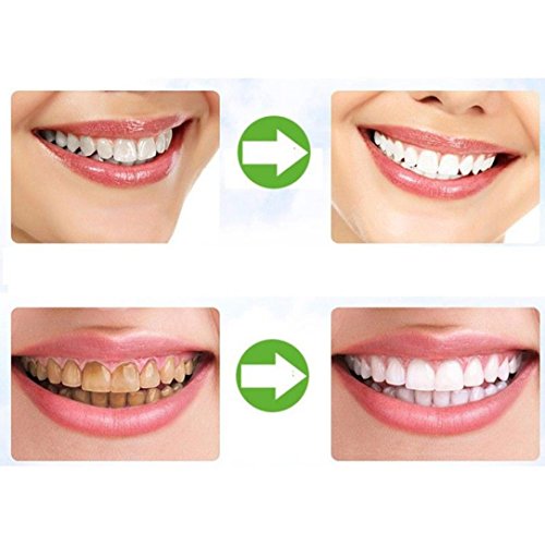 Natürliches Aktivkohle Zahnaufhellung pulver mit Aktivkohle pulver ( activated charcoal teeth whitening ) Mit Ingwerwurzel, Holeider Bentonit-Ton & Calcium NICHT-synthetisch & OHNE Chemikalien - 2