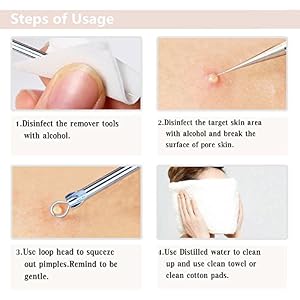 FabQuality 9pcs Blackhead Remover - Acne Pimple Comedone Extractor - Bonus eBook, Whitehead Removal Tool Kit Set of 9Pcs… - Image 5